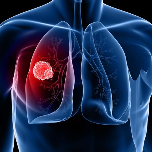 肺癌患者接受靶向治疗应该检测哪些基因？新指南发布啦！
