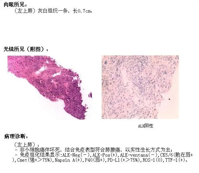 搞不明白的免疫组化和基因检测 小桔灯网 手机版